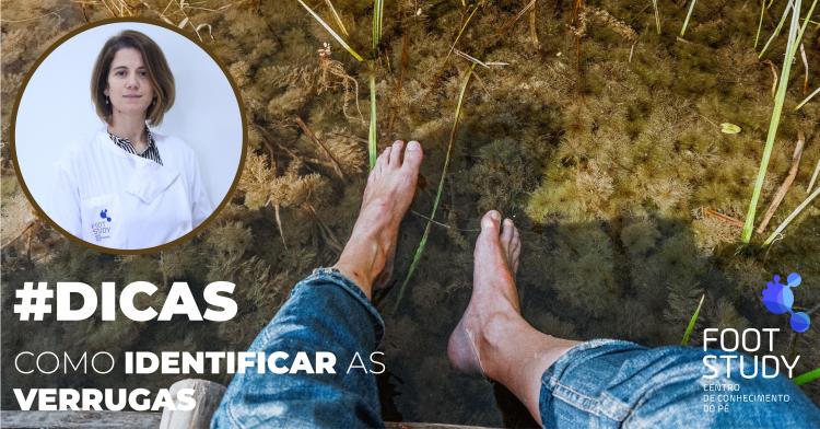HOW TO IDENTIFY WARTS